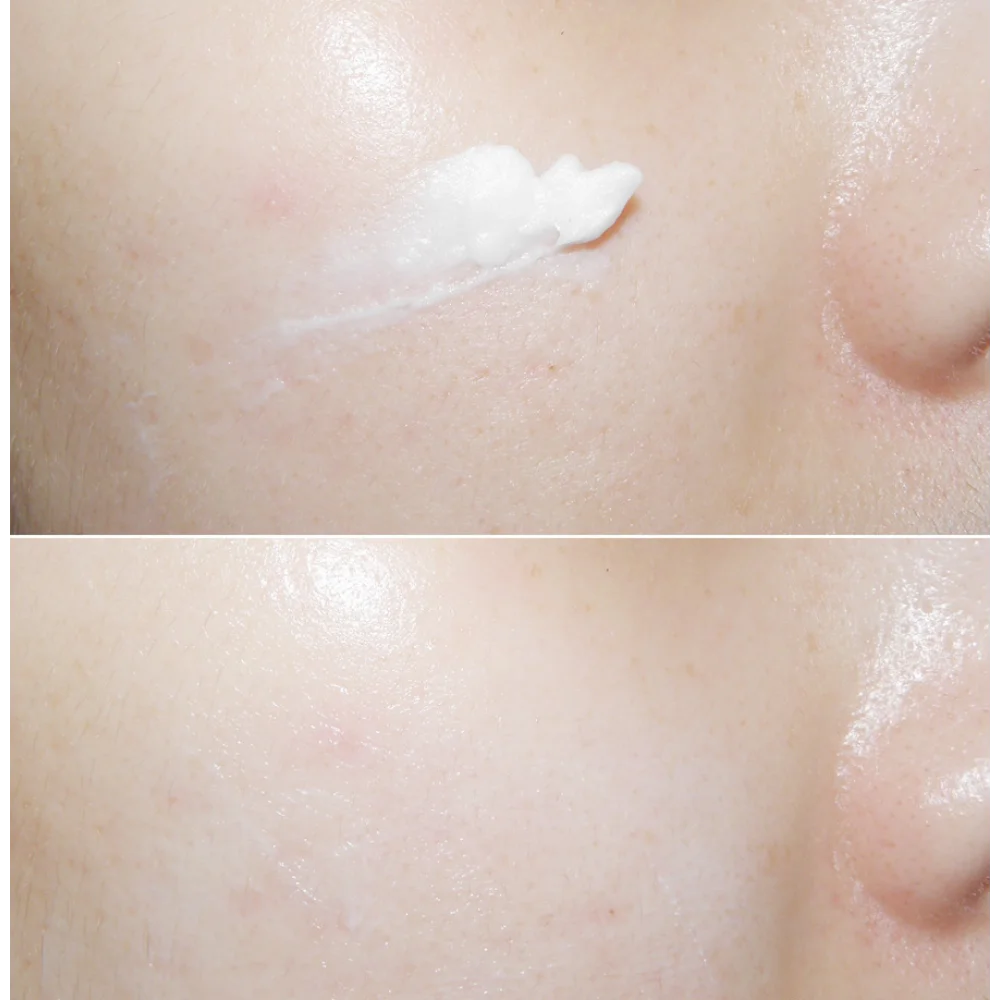 Korea Mizon Skin Recovery Nigh - Luxury Skincare Essence review and price