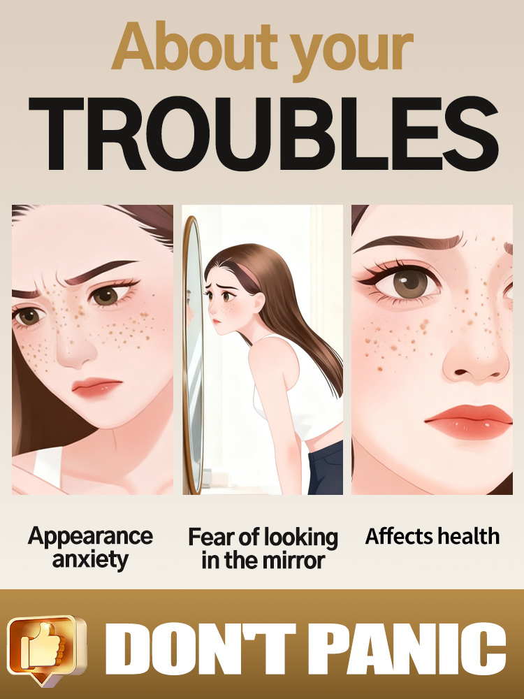 Lightening Facial Freckles Mel - Luxury Skincare Essence review and price
