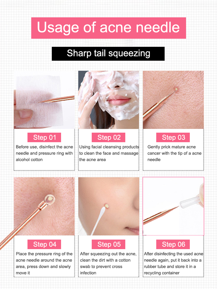 Blackhead Remover Pimple Comed - Luxury Skincare Acne review and price