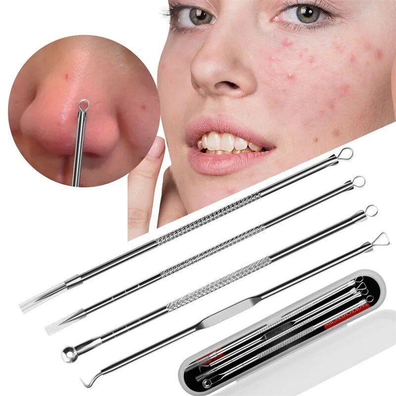 Blackhead Remover Tool Kit, St - Luxury Skincare Acne review and price
