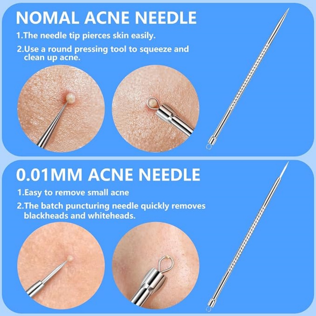 5PCS Blackhead Remover Comedon - Luxury Skincare Acne review and price