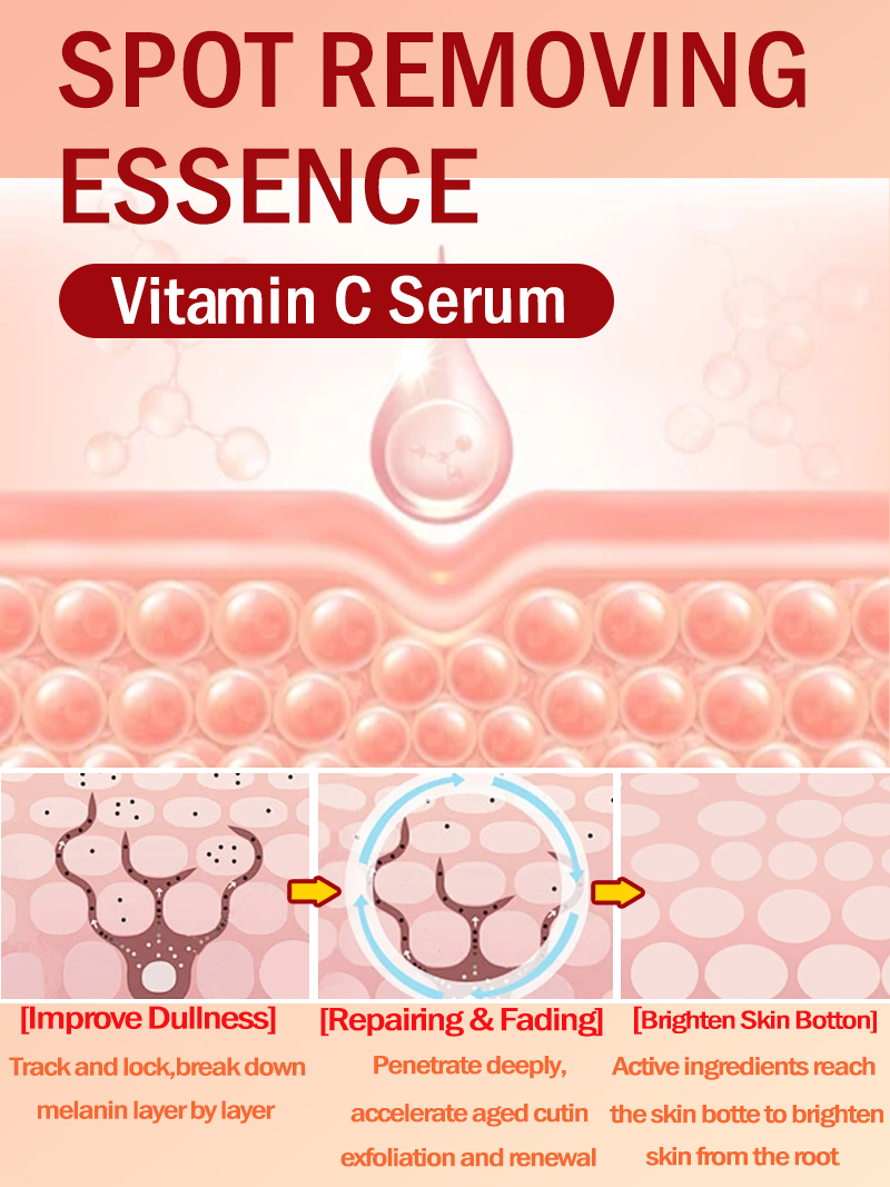 Lighten Freckles Melasma, Faci - Luxury Skincare Essence review and price